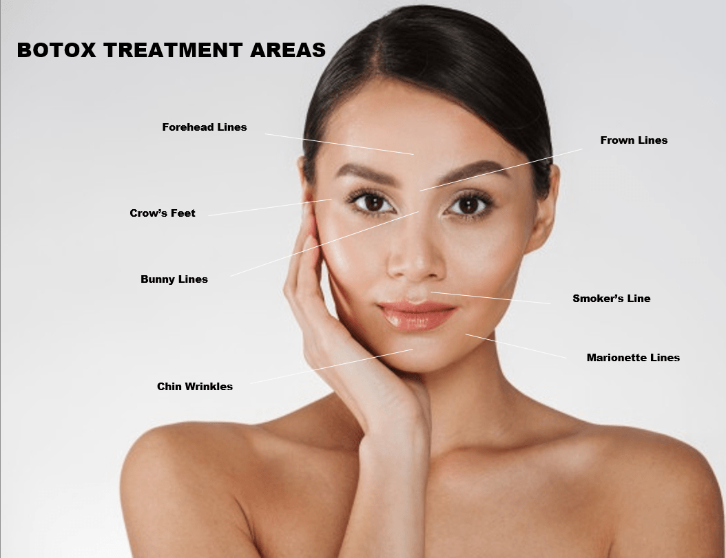 Botox Services – Pittsburgh, PA – Pittsburgh Dental Spa
